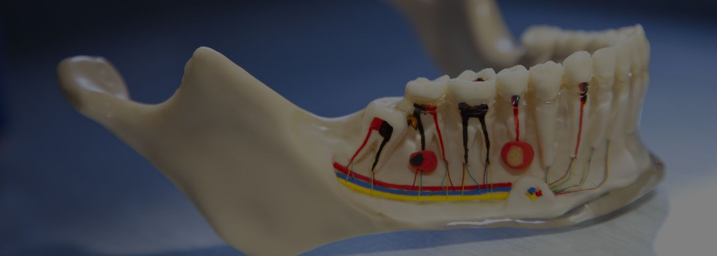 Root Canal Treatment / Endodontics
