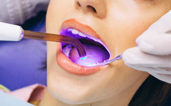 Laser Dentistry