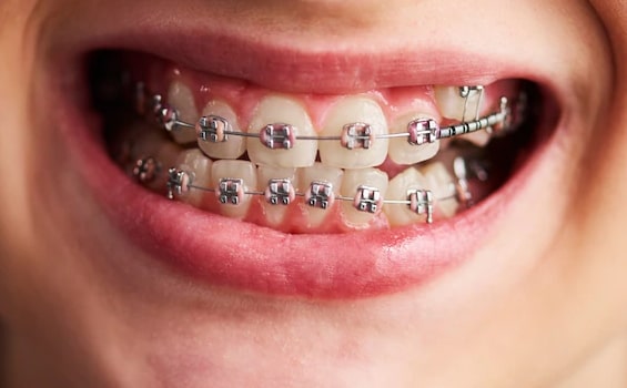 Orthodontics